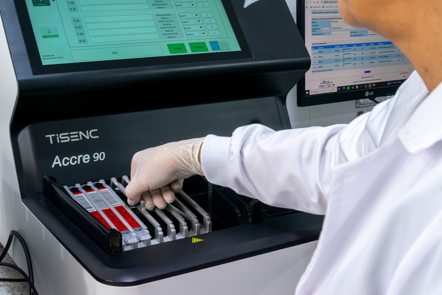 Exámenes de química clínica en NAIZIR